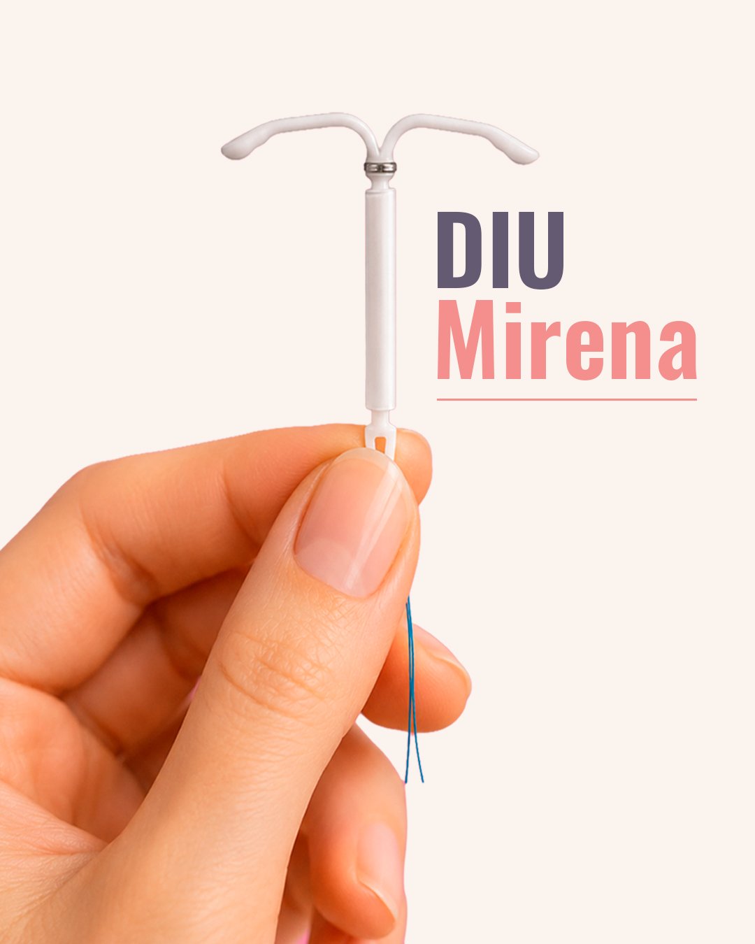 mirena1